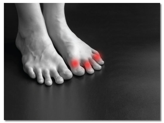 Foot culture - The best foot pain clinic in Secunderabad, Hyderabad